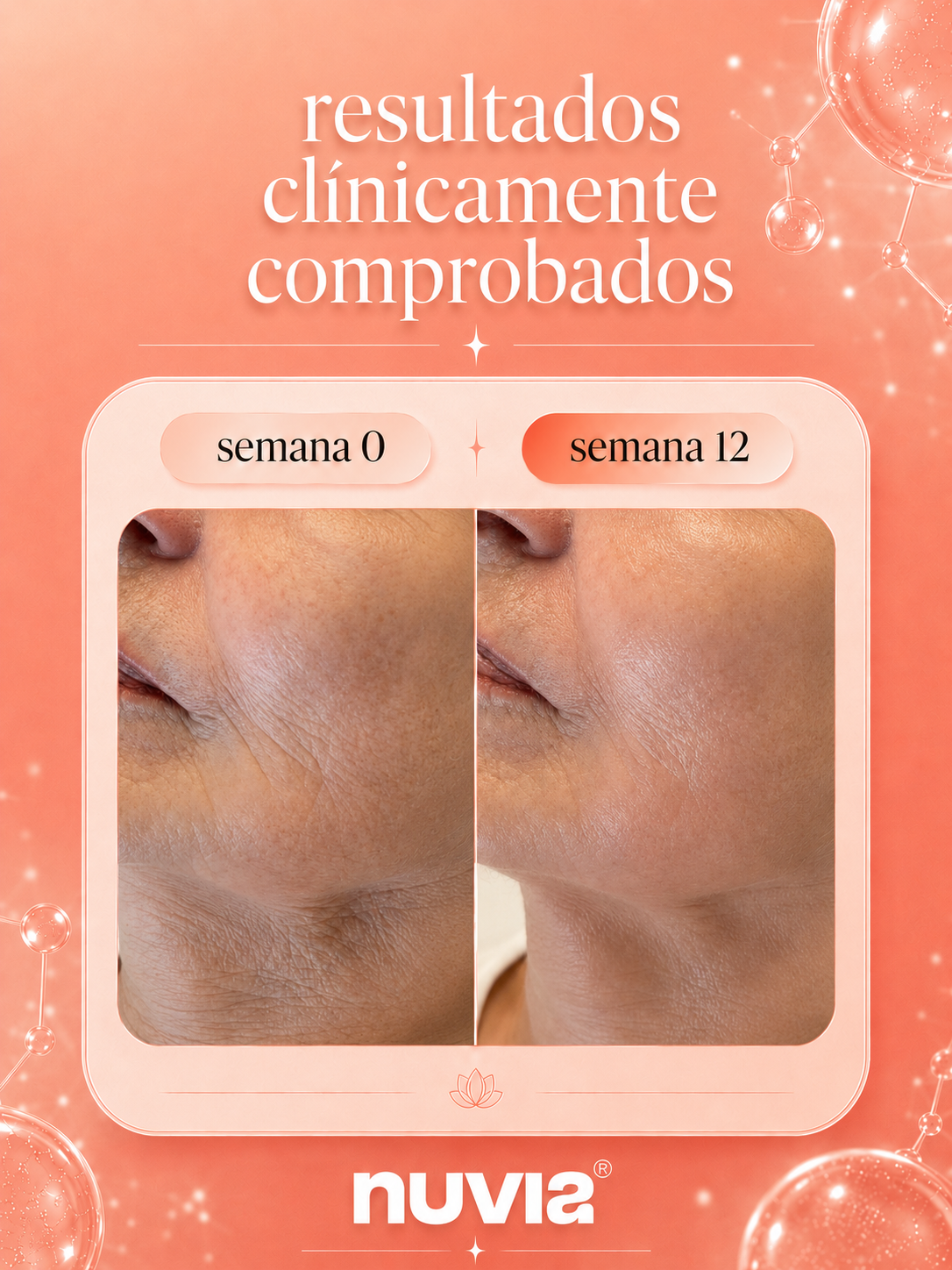 Nuvia Skin Bloom | Piel Firme y Luminosa