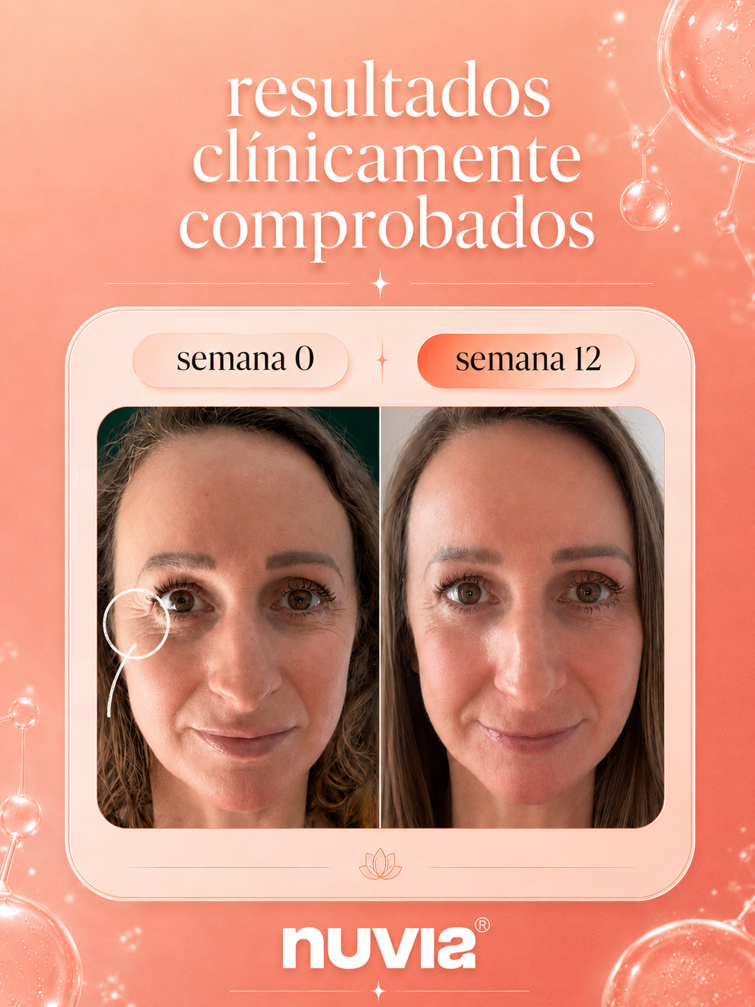 Nuvia Skin Bloom | Piel Firme y Luminosa